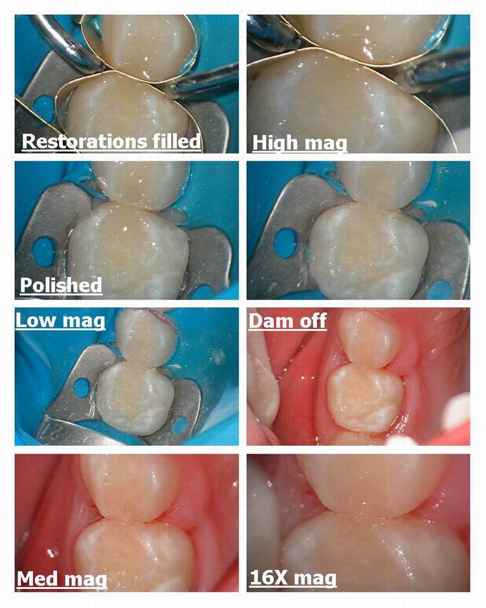 Resize of Class 2s without anesthetic pg 3.jpg